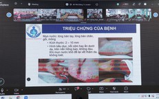 Siết chặt điều trị tay chân miệng: Nâng năng lực hồi sức, đảm bảo cách ly, chuyển tuyến an toàn