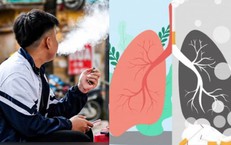 Sửa luật để chặn 'làn sóng nghiện' thuốc lá mới 