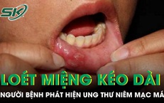 Loét miệng kéo dài, người bệnh phát hiện ung thư niêm mạc má