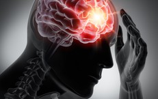 Nhận biết và xử trí chấn thương sọ não