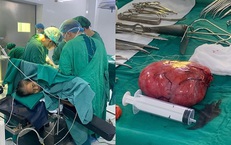 Phẫu thuật thành công khối u sau phúc mạc khổng lồ nằm ở vị trí phức tạp