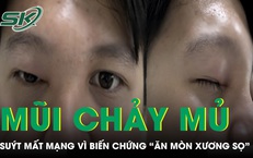 Mũi chảy mủ 4 ngày, nam thanh niên 20 tuổi suýt mất mạng