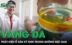 Vàng da, tắc mật do sán ký sinh trong đường mật gan