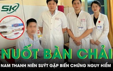 Nuốt 3 bàn chải dài 20cm, nam thanh niên suýt gặp biến chứng nguy hiểm 