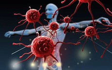 Những bộ phận nào trên cơ thể thường gây ung thư và cách phòng tránh hiệu quả