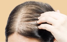 5 thói quen gây hại khiến tóc ngày càng mỏng đi