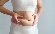 Vì sao người gầy vẫn có nhiều mỡ bụng?