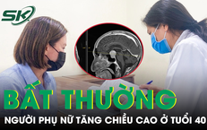 Người phụ nữ tăng chiều cao bất thường ở tuổi 40