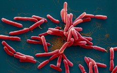 Bệnh Whitmore làm 23 người tử vong tại Thái Lan, Bộ Y tế khuyến cáo người dân 8 biện pháp phòng chống