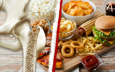 5 nhóm thực phẩm cần tránh khi bị loãng xương