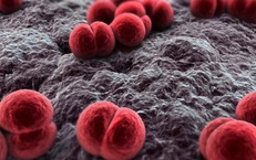 Ghi nhận 18 ca mắc não mô cầu tại phía Nam: Cách phòng bệnh hiệu quả