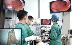 Người đàn ông cấp cứu sau bữa ngan luộc