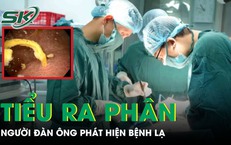 Người đàn ông tiểu ra phân, được phát hiện mắc bệnh lạ