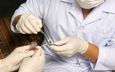 Ca hiến giác mạc đầu tiên tại Bệnh viện Đa khoa Bắc Ninh số 1
