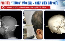 Người đàn ông bị phi tiêu cắm trúng đầu nhập viện khẩn cấp
