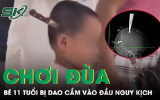 Hai anh em chơi đùa tại nhà, bé 11 tuổi bị dao cắm vào đầu nguy kịch