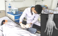 Vi phẫu cứu ngón tay đứt lìa cho nữ công nhân phụ hồ bị máy trộn bê tông cuốn nát bàn tay