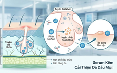 Serum kẽm: 'Chìa khóa' kiểm soát dầu nhờn và giải quyết bài toán mụn viêm