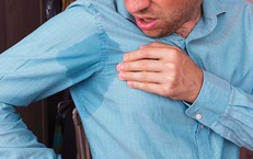 4 cách khắc phục mồ hôi nách mùa nắng nóng