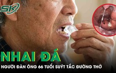 Nhai đá giải nhiệt, người đàn ông 66 tuổi suýt tắc đường thở