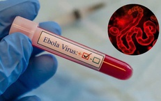 TPHCM tăng cường giám sát trước nguy cơ dịch Ebola xâm nhập