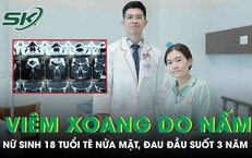 Viêm xoang do nấm, nữ sinh 18 tuổi tê nửa mặt, đau đầu suốt 3 năm