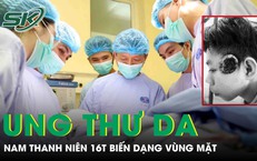 Nam thanh niên 16 tuổi ung thư da vỡ loét, gây biến dạng vùng mặt 
