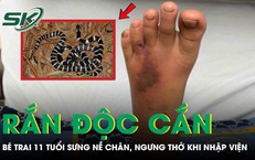 Bé trai 11 tuổi bị rắn độc cắn, sưng nề chân, ngưng thở khi nhập viện 
