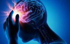 Cơn thiếu máu não thoáng qua: Dấu hiệu cảnh báo sớm nguy cơ đột quỵ