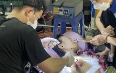 Vụ ông Nguyễn Tiến Nam: Bác sĩ nói gì về việc tự ý mổ u bằng dao điện cao tần?