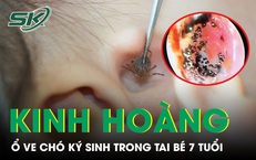 Kinh hoàng phát hiện ổ ve chó ký sinh trong tai bé trai 7 tuổi 