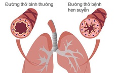 Khi nào người bệnh hen cần đến viện ngay lập tức?
