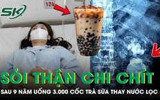Uống 3.000 cốc trà sữa thay nước lọc suốt 9 năm, thận cô gái mọc chi chít sỏi