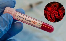 Dịch bệnh Ebola diễn biến phức tạp tại Châu Phi nhưng người dân không nên hoang mang