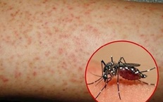 Hơn 1.100 ca mắc sốt xuất huyết, Lâm Đồng kích hoạt các biện pháp phòng, chống dịch