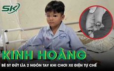 Kinh hoàng: Bé trai 5 tuổi đứt lìa 2 ngón tay khi chơi xe điện tự chế