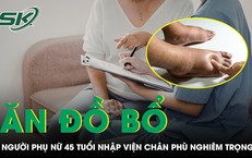 Ăn liên tục đồ bổ thận, người phụ nữ 45 tuổi nhập viện, chân phù nghiêm trọng