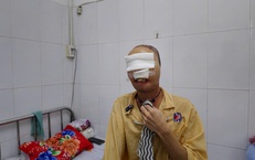 Hành trình 'làm lại gương mặt' cho chàng thanh niên mang di chứng bỏng suốt 3 năm