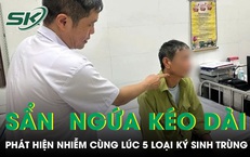 Ngứa suốt nửa năm, người đàn ông phát hiện nhiễm cùng lúc 5 loại ký sinh trùng 