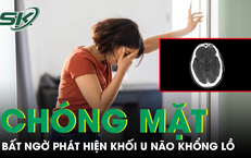 Chóng mặt xây xẩm, người phụ nữ bất ngờ phát hiện khối u não khổng lồ