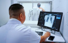 Khám sàng lọc cho hơn 6.500 người dân, phát hiện gần 600 ca mắc bệnh đường hô hấp