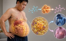 Vì sao đàn ông dễ béo bụng sau tuổi 35?