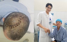 90 phút 'nghẹt thở' cứu người đàn ông bị vỡ lún sọ, tràn máu màng phổi