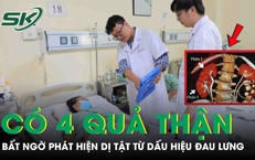 Người phụ nữ bất ngờ phát hiện mình có 4 quả thận từ dấu hiệu đau hông lưng
