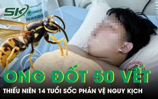 Bị ong vò vẽ đốt hơn 50 vết, thiếu niên 14 tuổi hoại tử, sốc phản vệ nguy kịch