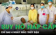 Người đàn ông suy hô hấp cấp chỉ sau 4 ngày mắc thủy đậu 