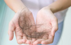 3 bí quyết hạn chế rụng tóc ở tuổi mãn kinh
