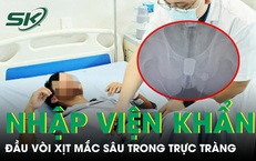 Người đàn ông nhập viện khẩn vì đầu vòi xịt mắc sâu trong trực tràng