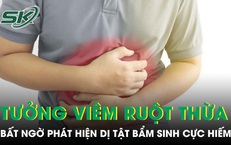 Đau bụng tưởng viêm ruột thừa cấp, bất ngờ phát hiện mắc dị tật bẩm sinh chỉ 2% người mắc 