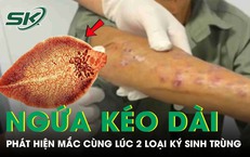 Người đàn ông tá hoả phát hiện mắc cùng lúc hai loại ký sinh trùng từ dấu hiệu ngứa kéo dài